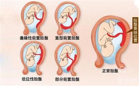 胎盤母體面|胎盤母體面的功能